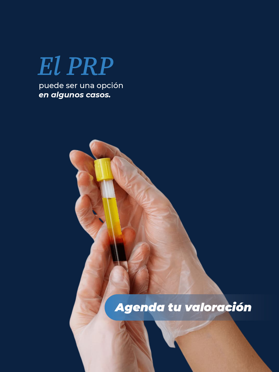 El PRP puede ser una opción en algunos casos, según la valoración médica