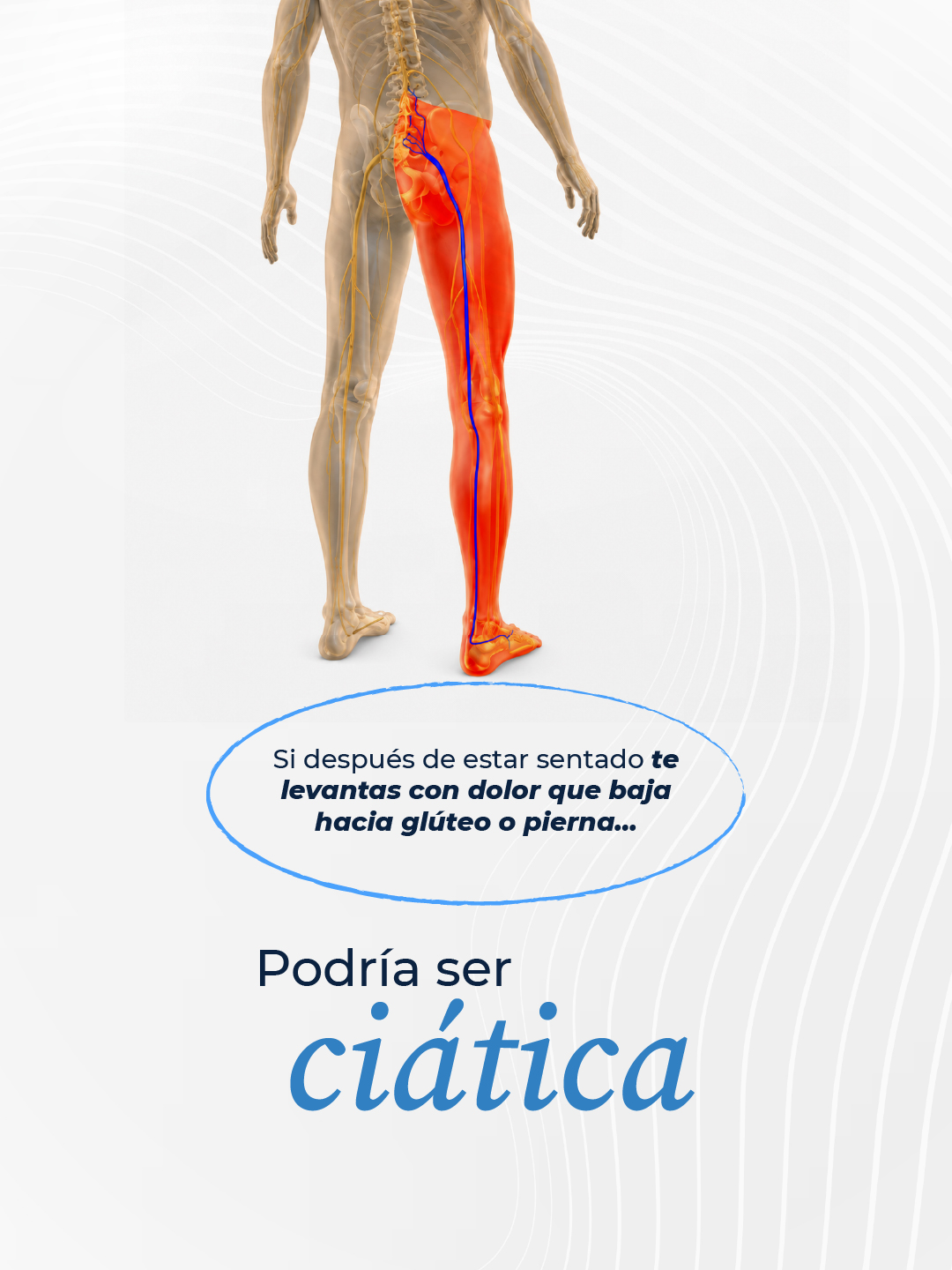 Dolor que baja del glúteo hacia la pierna, característico de la ciática