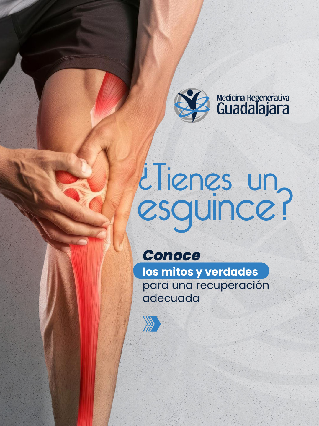 ¿Tienes un esguince? Conoce los mitos y verdades para una recuperación adecuada